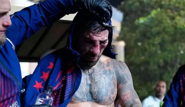 Así le quedó el rostro desfigurado a Ilia Topuria tras la brutal paliza en el UFC Freedom 250
