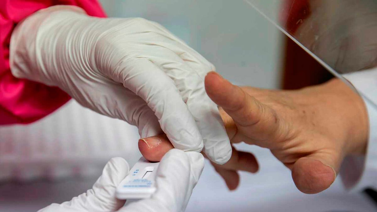 Como Interpretar Un Test Serologico Cómo se debe usar el primer test serológico rápido nacional - Diario