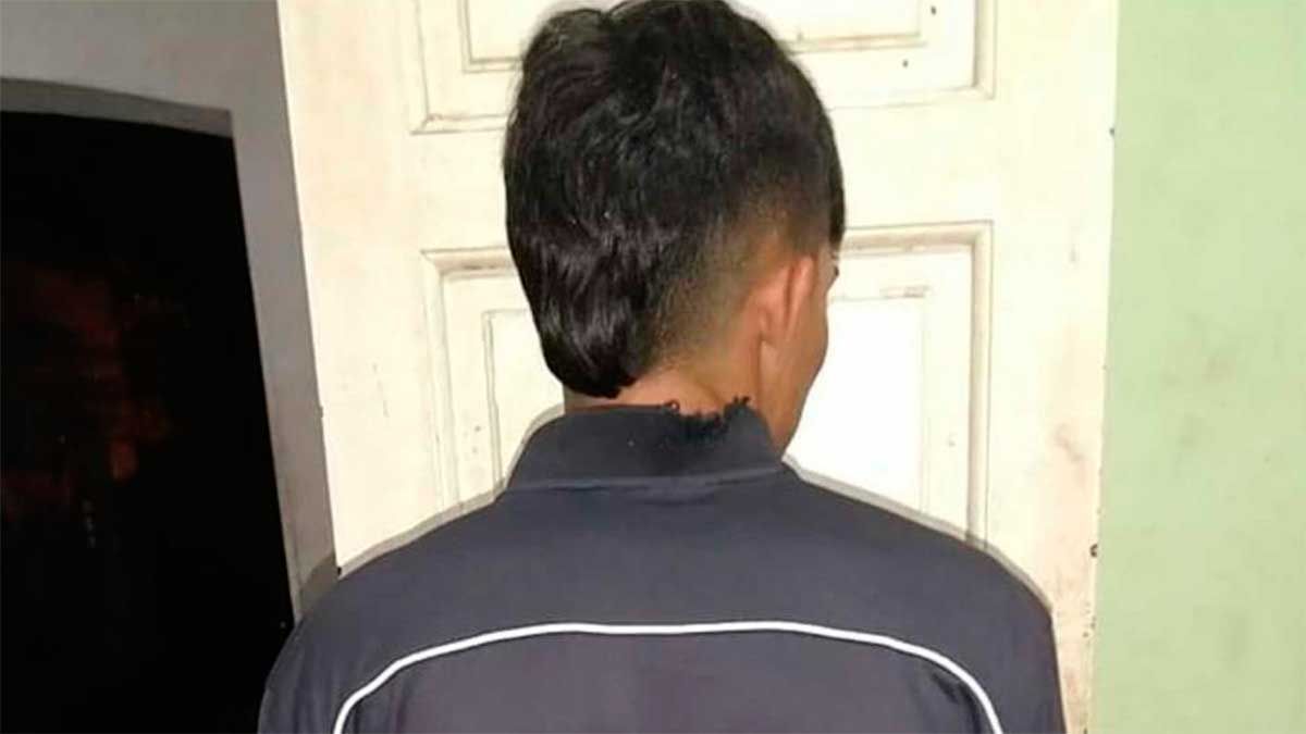 El muchacho logró ser detenido por la policía. 