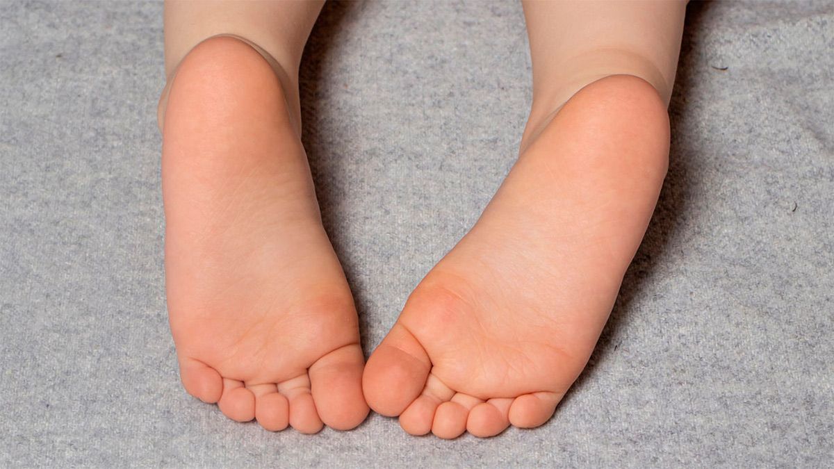 Pie plano cómo tratar correctamente para evitar molestias y complicaciones Diario Panorama