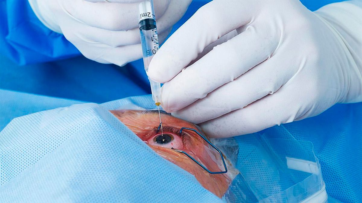 Tecnicas para recuperar la visión muestran en Argentina los avances