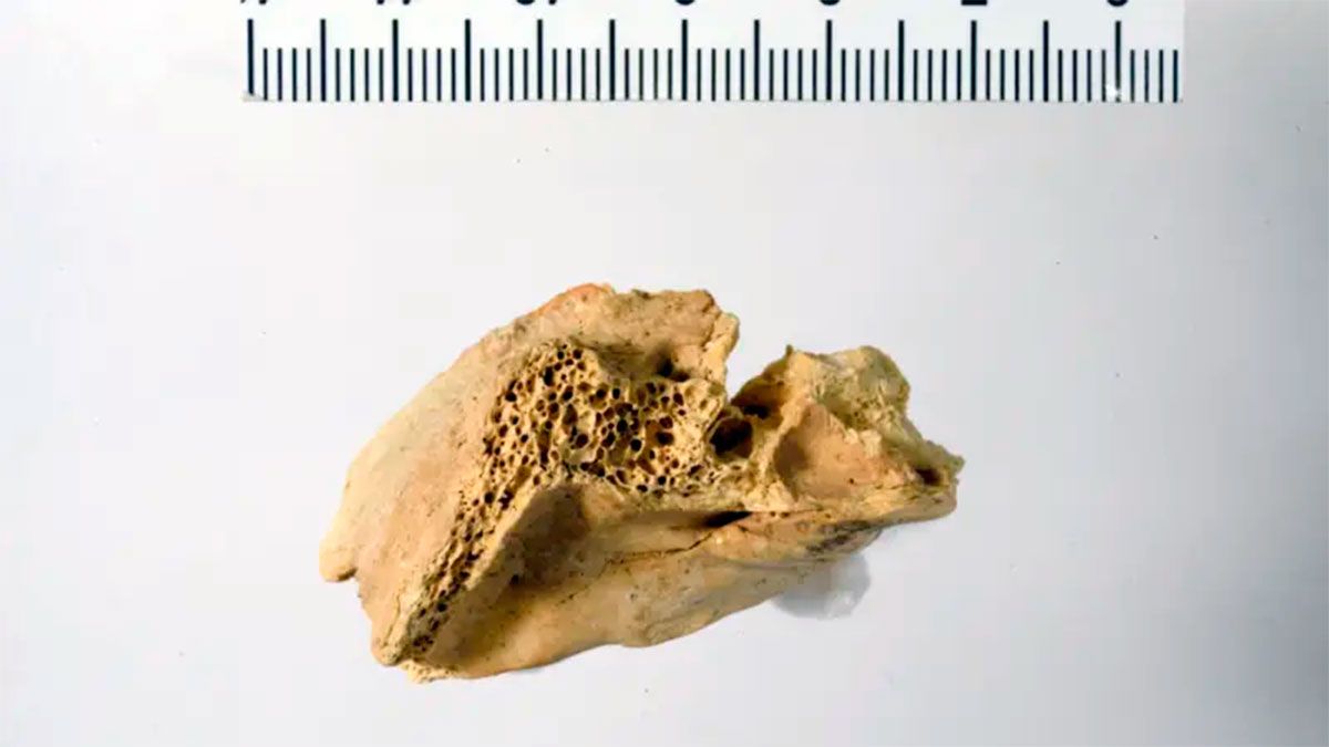 Reproducción 3D del hueso 