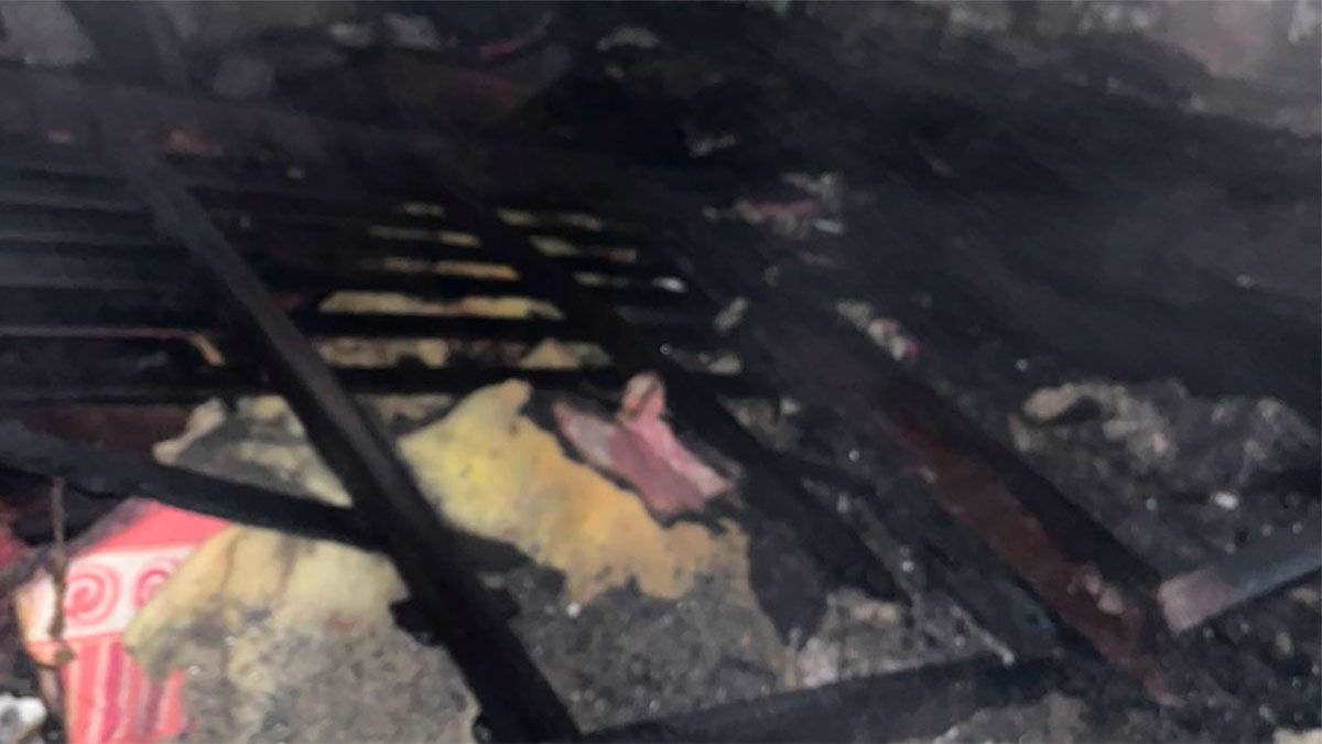 Frías: una mujer de 76 años sufrió graves quemaduras al caer una vela ...