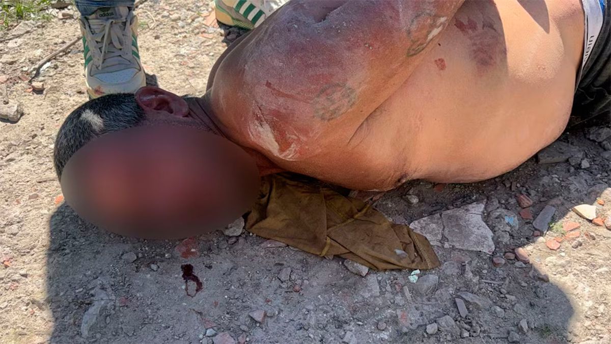 El padrastro fue atacado 