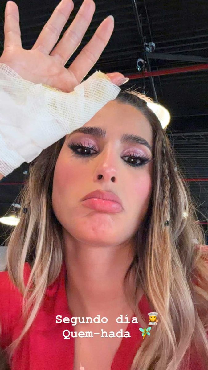 Julieta Poggio mostró en las redes sociales la herida que sufrió. 