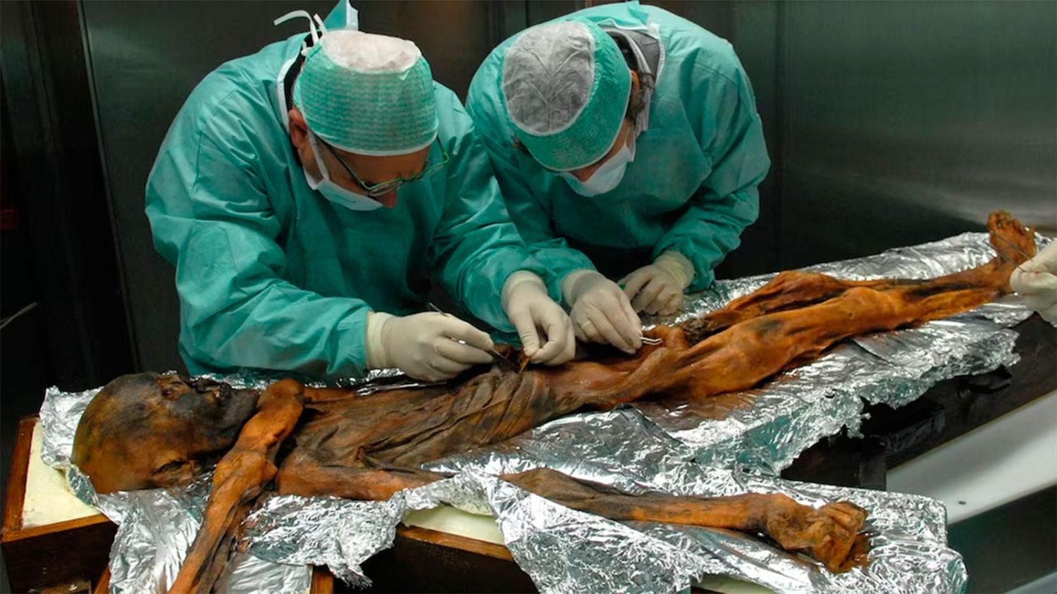 Otzi,  