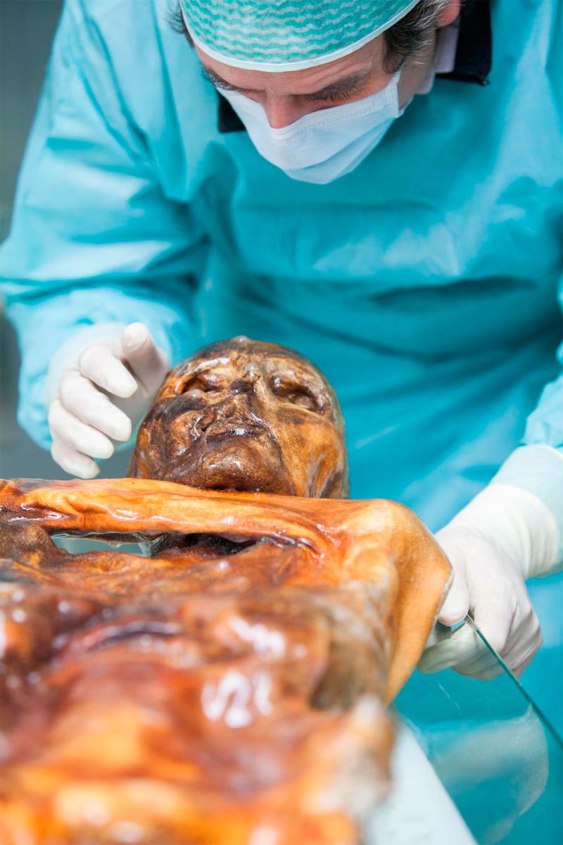 Otzi,  